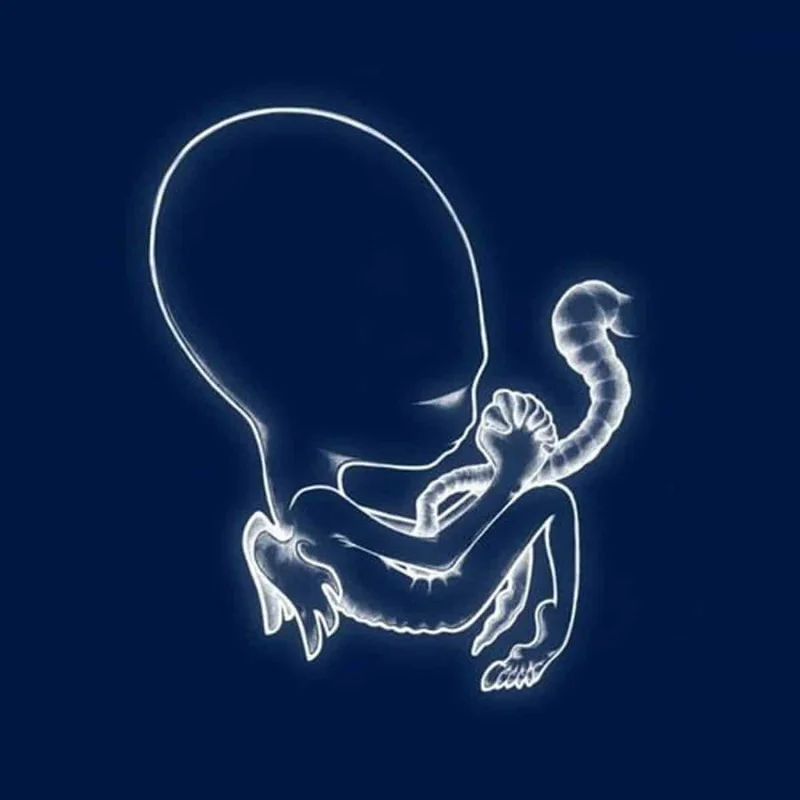 Sigur Rs  gtis Byrjun